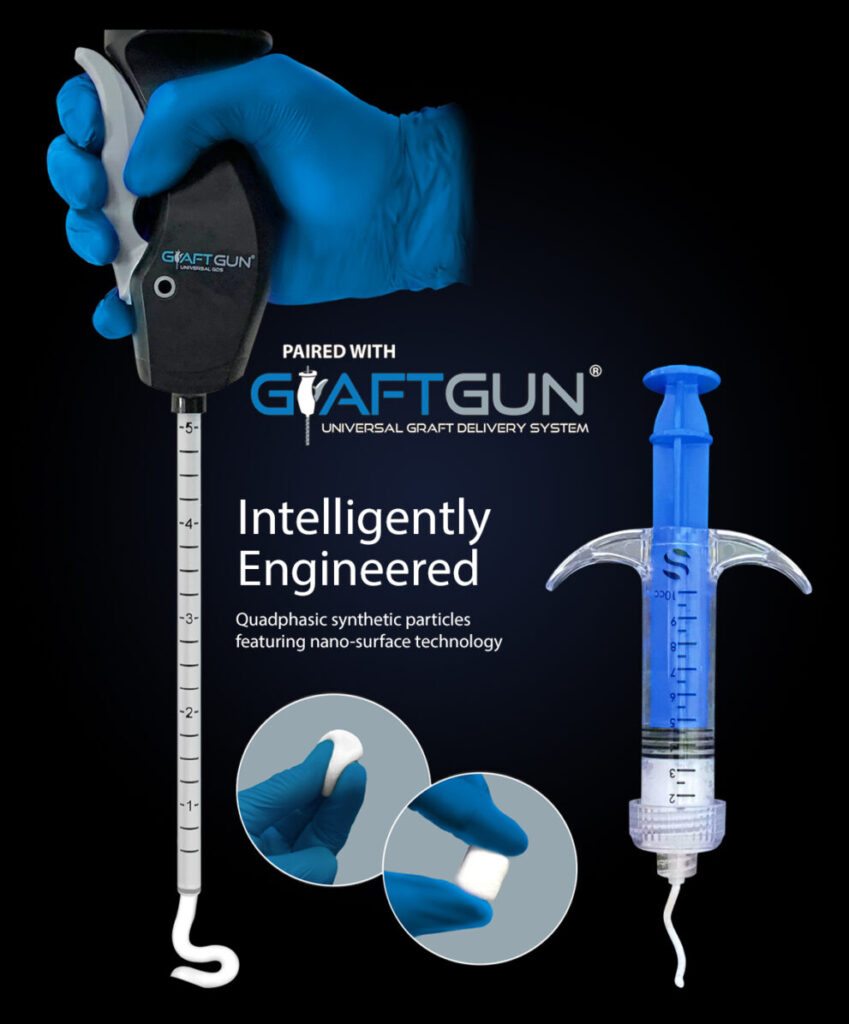 Synthetic Bone Graft Putty Ossify™ 100 DBM Putty