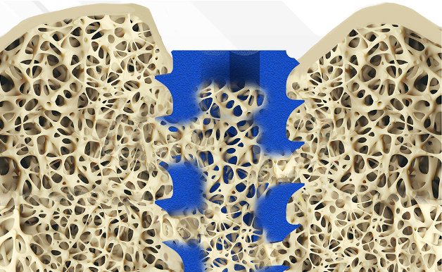 ion-c-Osteointegration_promotion-2026