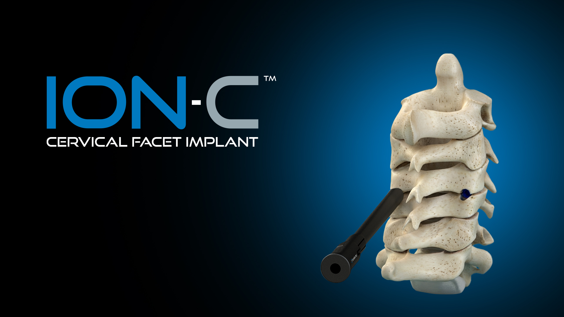 ion-c-cervical-facet-implant-hero